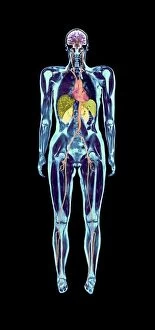 Diagnosis Collection: Full body scan, MRI scan