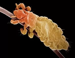Parasite Collection: Head louse, SEM