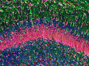 Slice Collection: Hippocampus brain tissue